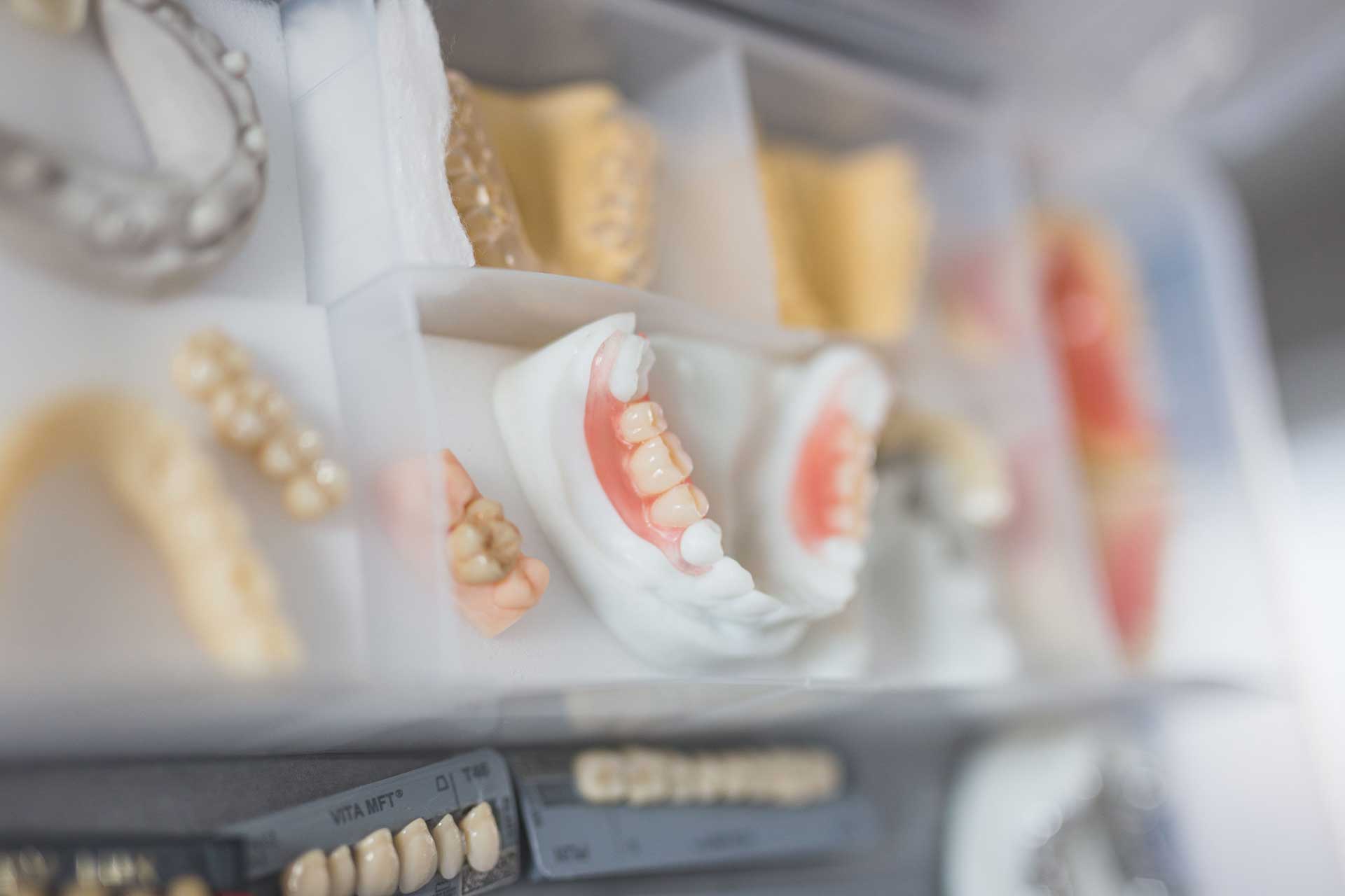 artificial-teeth-for-dental-healthcare-industry-2026-09-23-12-22-44-utc_1920 Dental2Ju Zahnersatz Dresden