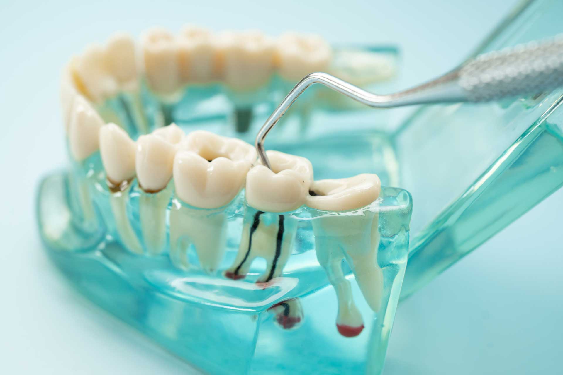 Dental2Ju Wurzelkanalbehandlung Dresden