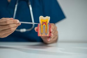 Dental2Ju Wurzelkanalbehandlung Dresden