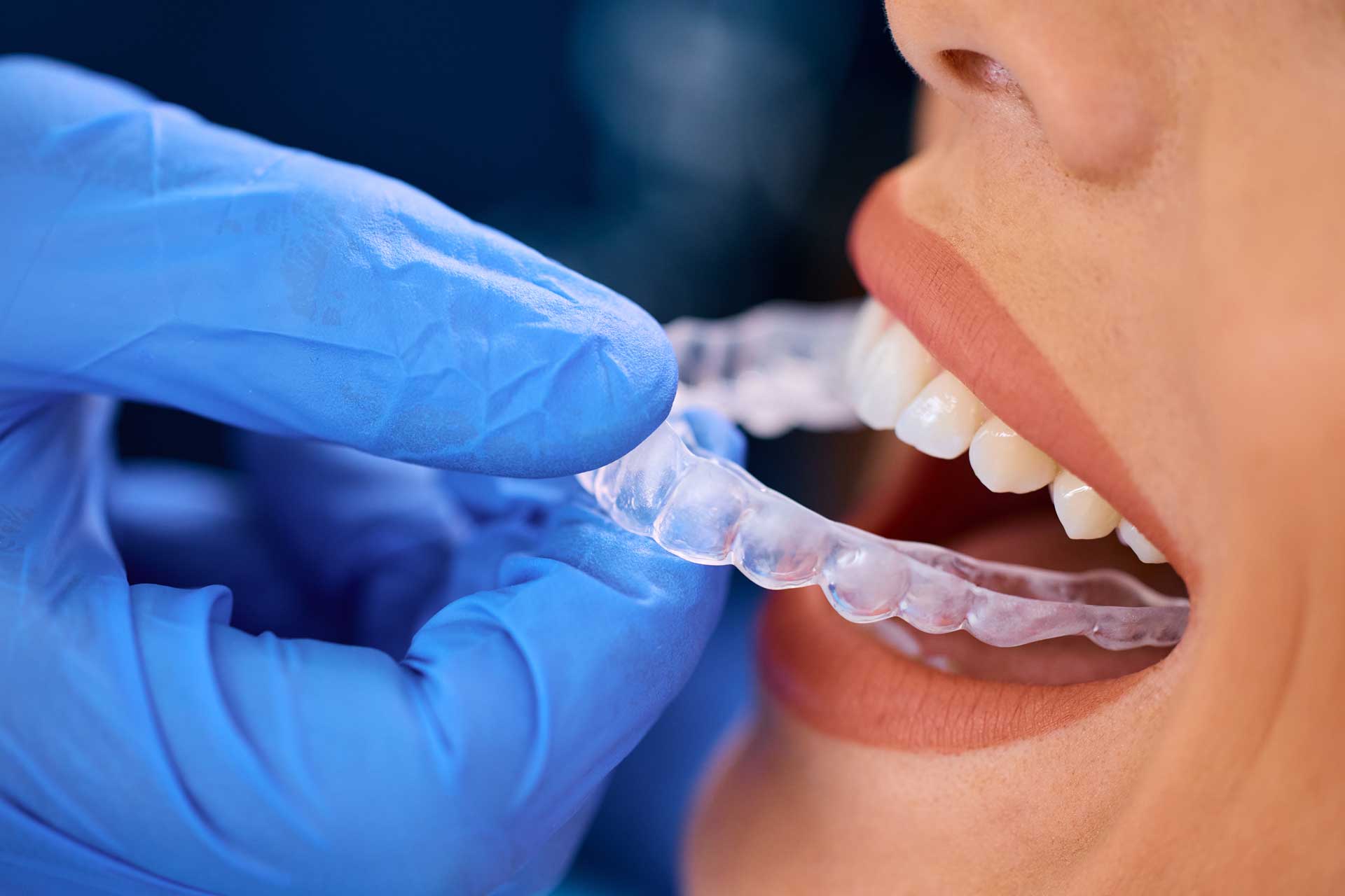 Dental2Ju Zahnbegradigung mit Alignern Dresden