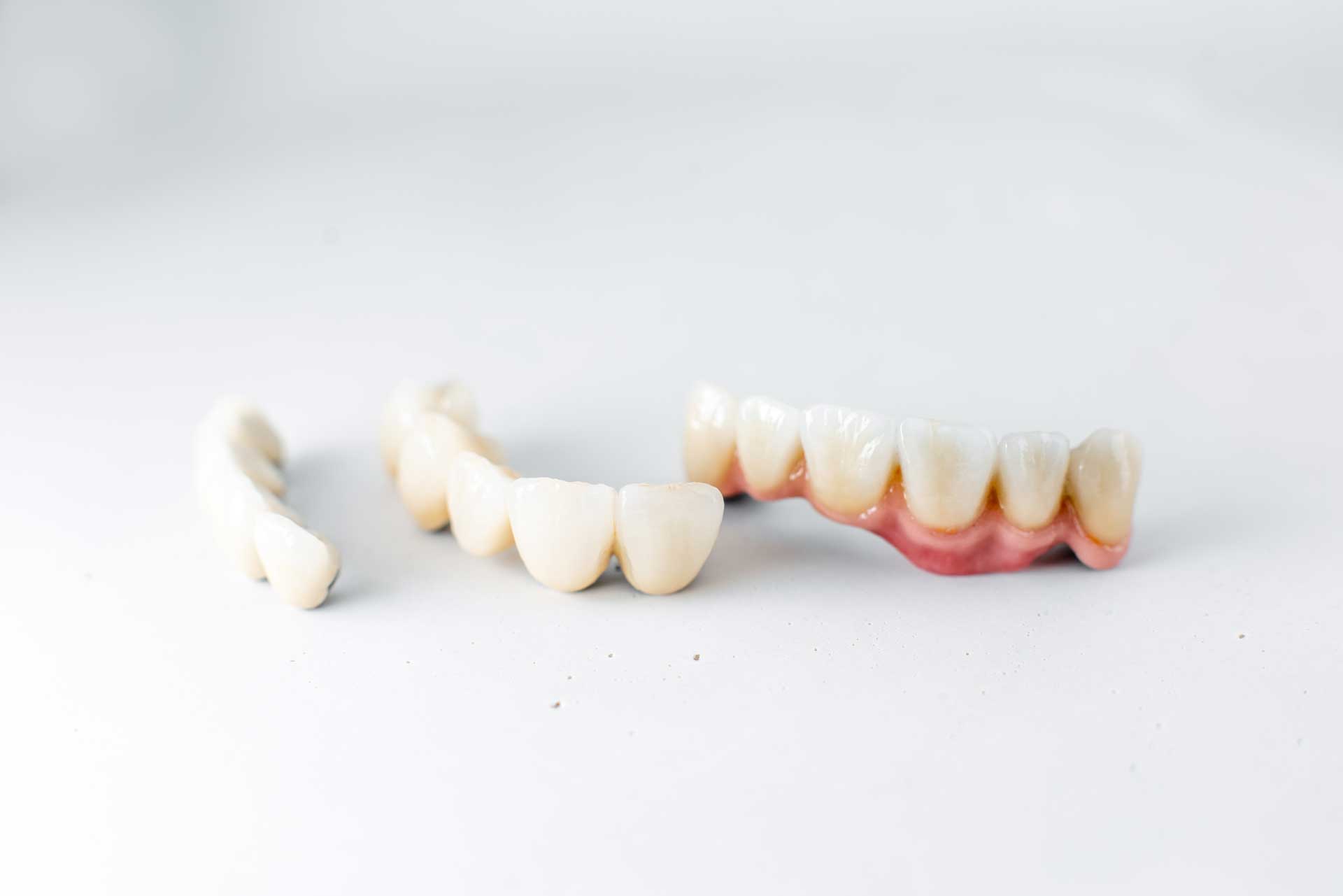dental-prosthetics-on-a-white-surface-2026-09-24-03-26-41-utc_1920 Dental2Ju Zahnersatz Dresden