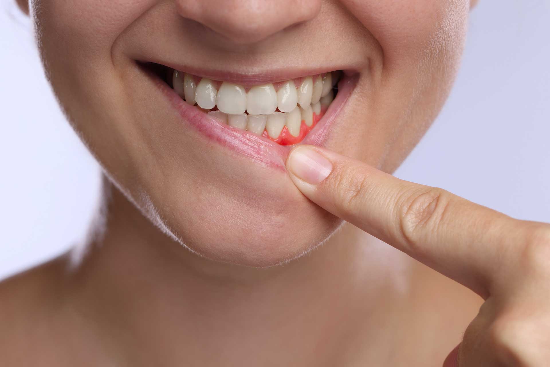 Dental2JU Wie wird eine Parodontitis behandelt?