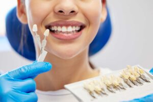 Dental2Ju Veneers Dresden